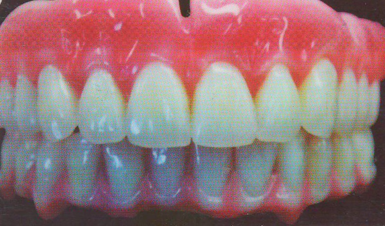 دندانسازی صنعتی